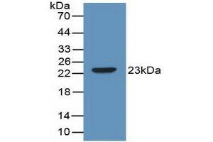 Detection of Recombinant IL2, Mouse using Polyclonal Antibody to Interleukin 2 (IL2) (IL-2 抗体  (AA 10-169))
