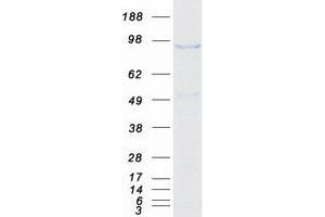Western Blotting (WB) image for Serine/threonine-Protein Phosphatase 4 Regulatory Subunit 3A (SMEK1) protein (Myc-DYKDDDDK Tag) (ABIN2732248)
