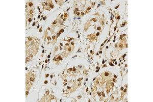 Immunohistochemistry of paraffin-embedded human stomach using NFATC1 antibody at dilution of 1:200 (x400 lens). (NFATC1 抗体)