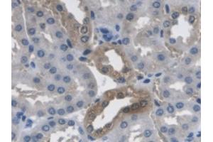 Detection of PCYOX1 in Mouse Kidney Tissue using Polyclonal Antibody to Prenylcysteine Oxidase 1 (PCYOX1) (PCYOX1 抗体  (AA 249-505))