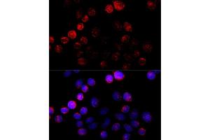 Immunofluorescence analysis of HeLa cells using Aromatase (CYP19) antibody (2684) at dilution of 1:100 (40x lens). (Aromatase 抗体  (AA 1-180))