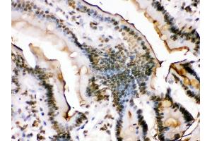 Immunohistochemistry (Paraffin-embedded Sections) (IHC (p)) image for anti-FBJ Murine Osteosarcoma Viral Oncogene Homolog B (FOSB) (AA 264-291), (C-Term) antibody (ABIN3042399) (FOSB 抗体  (C-Term))