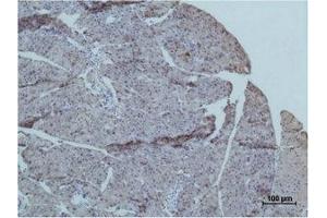 Immunohistochemical analysis of paraffin-embedded Mouse PancreasTissue using TRIM72 Polyclonal Antibody. (TRIM72 抗体)