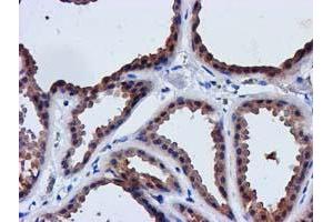 Immunohistochemical staining of paraffin-embedded Human breast tissue using anti-LACTB2 mouse monoclonal antibody. (LACTB2 抗体  (AA 78-288))