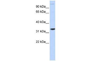 ANP32B antibody used at 1 ug/ml to detect target protein. (ANP32B 抗体)