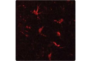 Staining of microglial cells in Mouse cerebral cortex (red) using MAC-1 Antibody . (CD11b 抗体)