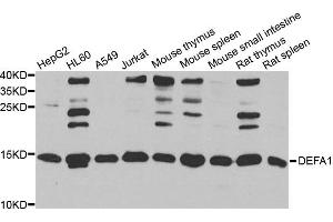 Western blot analysis of extracts of various cell lines, using DEFA1 antibody (ABIN5974152) at 1/1000 dilution. (alpha Defensin 1 抗体)