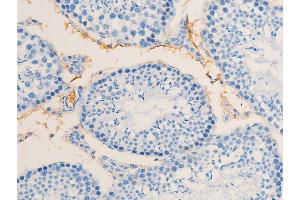Immunohistochemistry (IHC) image for anti-Receptor tyrosine-protein kinase erbB-2 (ErbB2/Her2) (pTyr1112) antibody (ABIN6255774)