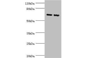Western blot All lanes: Amyloid-like protein 1 antibody at 6 μg/mL Lane 1: Mouse brain tissue Lane 2: A549 whole cell lysate Secondary Goat polyclonal to rabbit IgG at 1/10000 dilution Predicted band size: 72 kDa Observed band size: 72 kDa (APLP1 抗体  (AA 39-300))