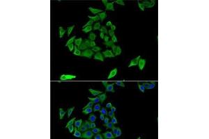 Immunofluorescence analysis of U2OS cells using TGM3 Polyclonal Antibody (TGM3 抗体)