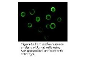 Image no. 3 for anti-Bruton Agammaglobulinemia tyrosine Kinase (BTK) antibody (ABIN232137) (BTK 抗体)