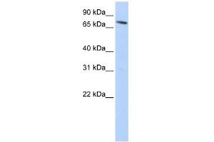 SLC11A2 antibody used at 1 ug/ml to detect target protein. (SLC11A2 抗体  (N-Term))