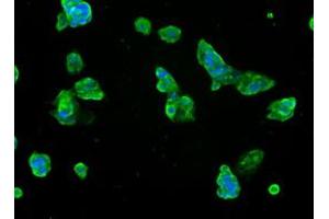 Immunofluorescent staining of HepG2 cells using anti-SLC7A8 mouse monoclonal antibody (ABIN2453649). (SLC7A8 抗体)