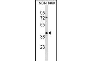 Western blot analysis in NCI-H460 cell line lysates (35ug/lane). (UCHL5 抗体  (AA 136-164))