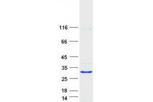Western Blotting (WB) image for GLI Pathogenesis-Related 2 (GLIPR2) protein (Myc-DYKDDDDK Tag) (ABIN2721691)