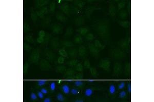Immunofluorescence analysis of U2OS cells using ATP1A1 Polyclonal Antibody at dilution of 1:100. (ATP1A1 抗体)