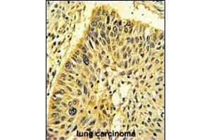 Immunohistochemistry (Paraffin-embedded Sections) (IHC (p)) image for anti-Calponin 1 (CNN1) (AA 10-39), (N-Term) antibody (ABIN390766)