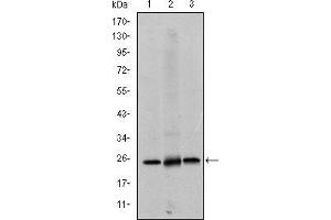 Western blot analysis using EIF4E mouse mAb against Hela (1), HEK293 (2) and K562 (3) cell lysate. (EIF4E 抗体)