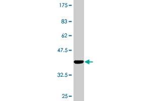 Western Blot detection against Immunogen (37. (SIRT3 抗体  (AA 297-399))