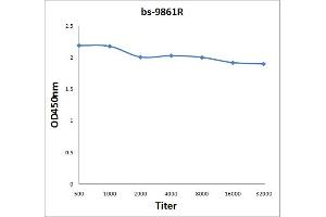 Antigen: 2 µg/100 µL  Primary: Antiserum, 1:500, 1:1000, 1:2000, 1:4000, 1:8000, 1:16000, 1:32000;  Secondary: HRP conjugated Rabbit Anti-Goat IgG at 1: 5000;  TMB staining Read the data in Microplate Reader by 450nm. (Titin 抗体  (AA 2670-2703))