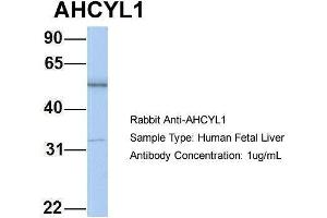 Hum. (AHCYL1 抗体  (N-Term))