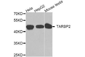 Western blot analysis of extracts of various cell lines, using TARBP2 antibody. (TARBP2 抗体  (AA 1-366))