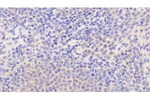 Detection of PADI1 in Human Spleen Tissue using Polyclonal Antibody to Peptidyl Arginine Deiminase Type I (PADI1)