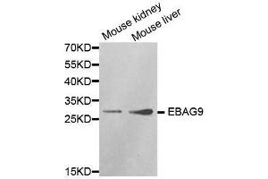 Western Blotting (WB) image for anti-Estrogen Receptor Binding Site Associated, Antigen, 9 (EBAG9) (AA 28-213) antibody (ABIN3023673)