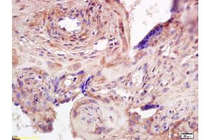 Immunohistochemistry (IHC) image for anti-ADAM Metallopeptidase with Thrombospondin Type 1 Motif, 7 (ADAMTS7) (AA 1601-1686) antibody (ABIN668586)