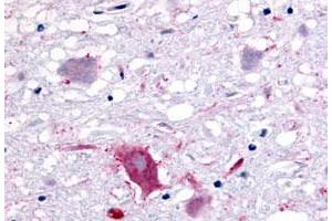 Immunohistochemistry (Formalin/PFA-fixed paraffin-embedded sections) of human brain, neurons and glia with GPR32 polyclonal antibody . (GPR32 抗体  (3rd Extracellular Domain))