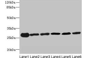 Western blot All lanes: TMED9 antibody at 4. (TMED9 抗体  (AA 40-197))