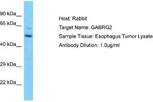 Host: Rabbit Target Name: GABRG2 Sample Type: Esophagus Tumor lysates Antibody Dilution: 1. (GABRG2 抗体  (N-Term))