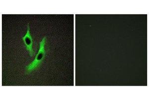 Immunofluorescence (IF) image for anti-STEAP Family Member 4 (STEAP4) (Internal Region) antibody (ABIN1849702) (STEAP4 抗体  (Internal Region))