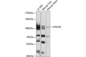 Western blot analysis of extracts of various cell lines, using NSUN2 antibody (ABIN1681117, ABIN3017797, ABIN3017798 and ABIN6220260) at 1:1000 dilution. (NSUN2 抗体  (AA 508-767))