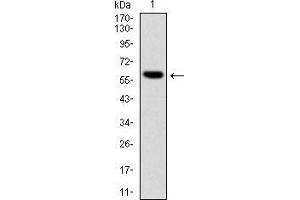 Western blot analysis using BLNK mAb against human BLNK (AA: 34-216) recombinant protein. (B-Cell Linker 抗体)