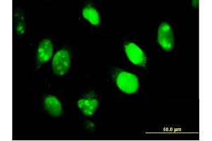 Immunofluorescence of monoclonal antibody to IFI16 on HeLa cell. (IFI16 抗体  (AA 630-729))