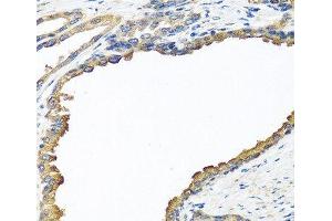 Immunohistochemistry of paraffin-embedded Human prostate using NYX Polyclonal Antibody at dilution of 1:100 (40x lens). (Nyctalopin 抗体)