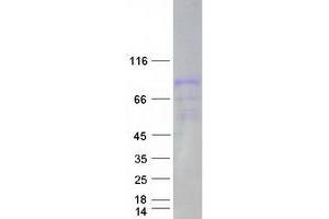 Validation with Western Blot