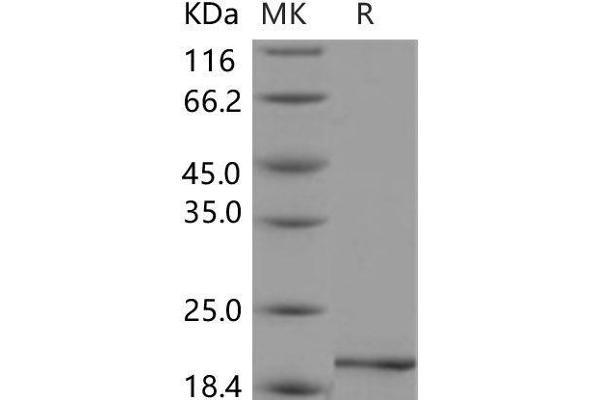 Pleiotrophin Protein (PTN)