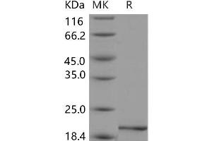 Western Blotting (WB) image for Pleiotrophin (PTN) (Active) protein (ABIN7197415) (Pleiotrophin Protein (PTN))