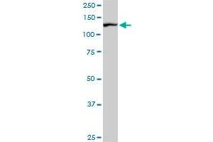 CAND1 monoclonal antibody (M02), clone 5F2. (CAND1 抗体  (AA 1-100))