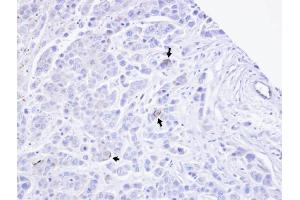 Immunohistochemistry (IHC) image for anti-Transient Receptor Potential Cation Channel, Subfamily M, Member 2 (TRPM2) (N-Term) antibody (ABIN2856853)