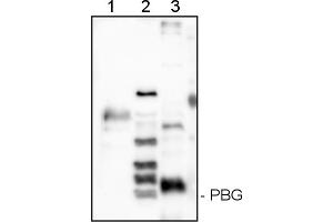 Image no. 1 for anti-Porphobilinogen-Deaminase (PBG) (HemC ) antibody (ABIN334586) (Porphobilinogen-Deaminase (PBG) (HemC ) 抗体)