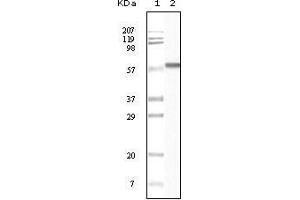 Western Blot showing CK1 antibody used against truncated CK1 recombinant protein. (CSNK1A1 抗体)