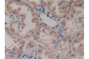 Detection of GSTt2 in Human Kidney Tissue using Polyclonal Antibody to Glutathione S Transferase Theta 2 (GSTt2) (GSTT2 抗体  (AA 15-235))