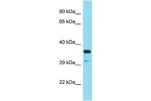 Host: Rabbit Target Name: RSPO3 Sample Type: HT1080 Whole Cell lysates Antibody Dilution: 1.