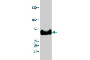 Western blot analysis from 40 ug HeLa nuclear extracts using MECP2 polyclonal antibody  at 1:1000 dilution. (MECP2 抗体  (C-Term))