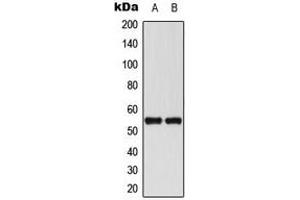 Western blot analysis of RUNX1 expression in THP1 (A), Jurkat (B) whole cell lysates.