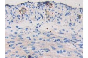 Immunohistochemistry (IHC) image for anti-Nexilin (NEXN) (AA 421-607) antibody (ABIN7443539)