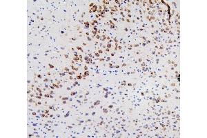 IHC analysis of RET using anti-RET antibody (ABIN6719502). (Ret Proto-Oncogene 抗体  (AA 29-304))